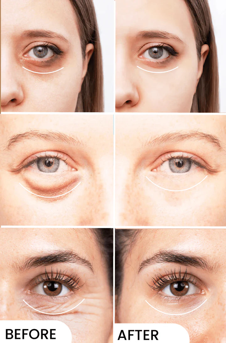Eyelight | Brightening & Refreshing Eye Area Serum